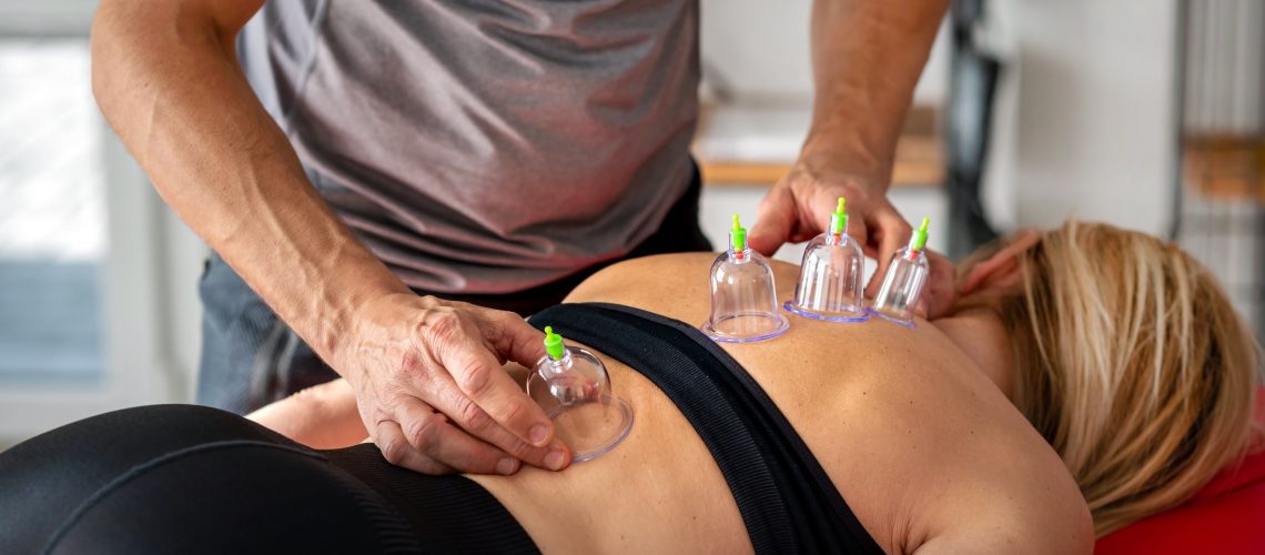 Image showing a physical therapist using cupping therapy on a client